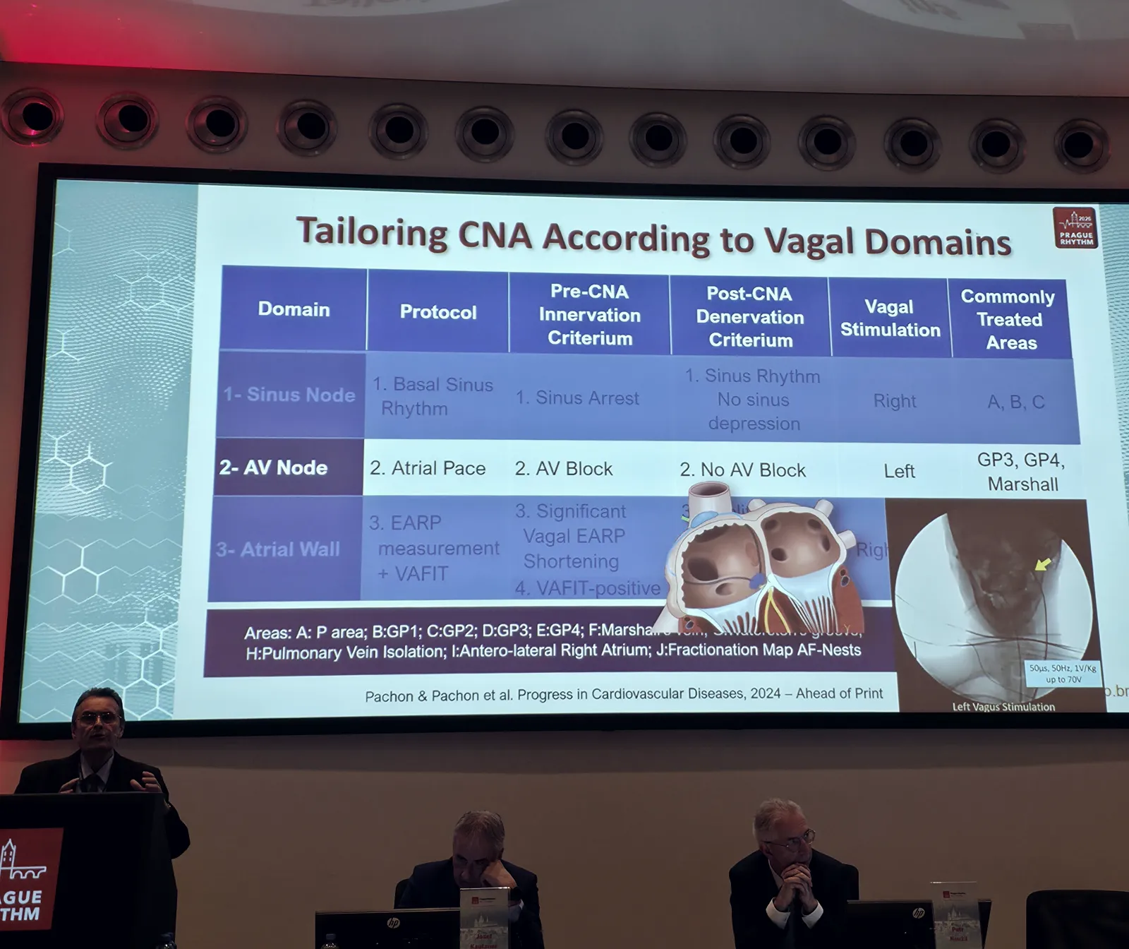 Wide view of the Prague Rhythm 2026 stage, with a speaker at the podium, two panelists seated nearby, and the slide 'Tailoring CNA According to Vagal Domains' on the main screen.